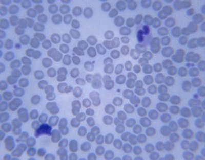 Microscopic image of lymphocytes