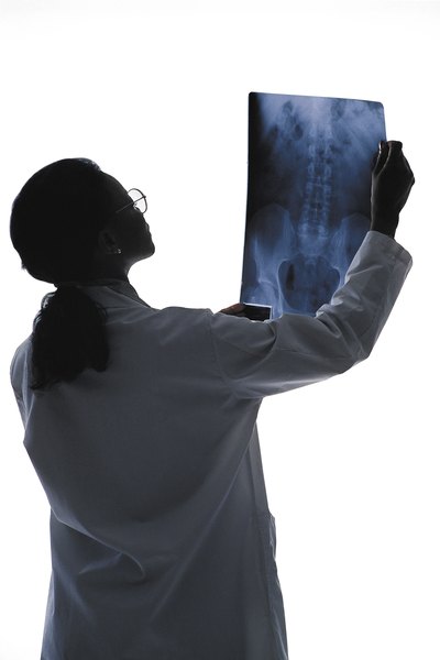 Doctor reading xray
