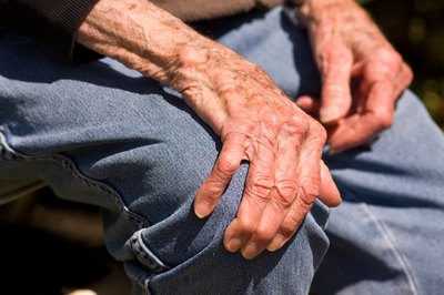 Elderly man with liver spots on his arms and hands