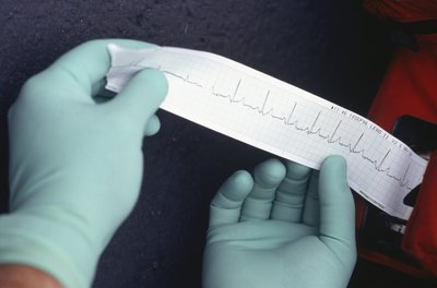 Nurse reading EKG results