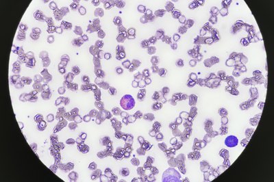 Eosinophil under microscope.