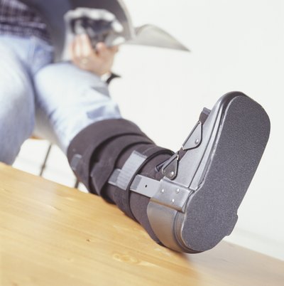 Leg injury