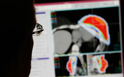 Patients receiving radiation therapy to treat cancer are at risk for lung damage.
