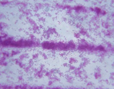 Microscopic view of Tuberculosis.