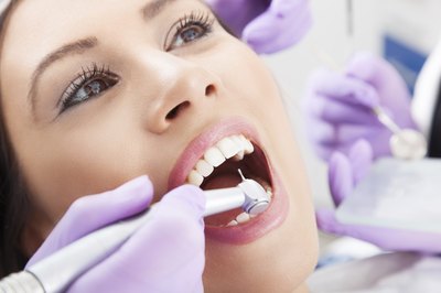 White spots are caused by decalcification.
