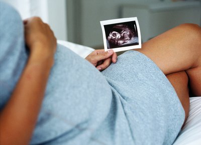 If the ultrasound technician sees a problem on the 3D/4D imaging, they will switch back to 2D to print out continuous pictures and investigate the source of the problem.
