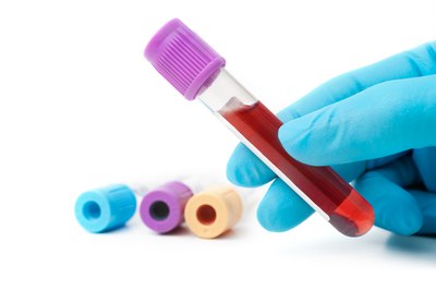 Blood sample.