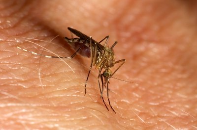 For those infected with HIV, there may be an exaggerated reaction to insect bites.