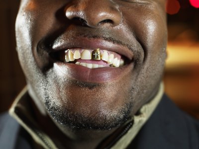 Missing tooth