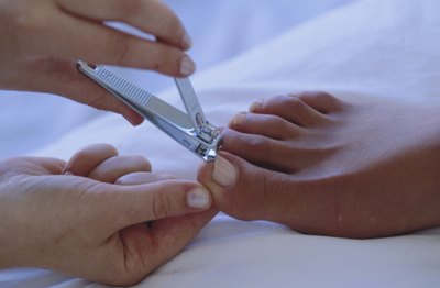 Nail fungus can be spread through the use of a shared toenail clipper.