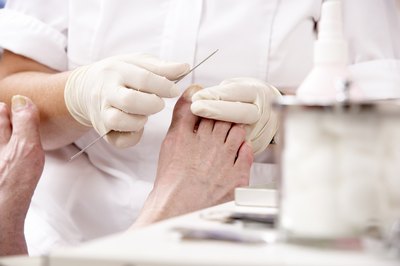 During tendon release the tendon is cut.