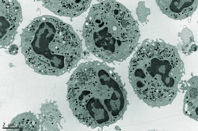 electron microscopic image of neutrophils