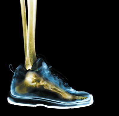 Shoe x-ray