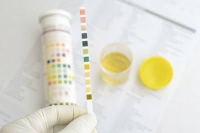 Timed specimens are collected to measure to concentration of specific electrolytes.