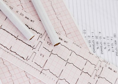 Heart attacks feature dizziness and clammy skin.