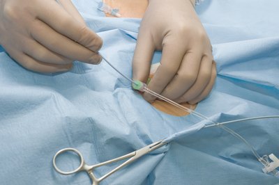 A catheter.