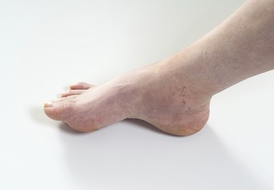Avoid swelling in lower legs.