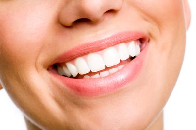 Most over-the-counter strips are made from a peroxide formula.
