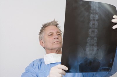 Doctors can spot hemangiomas in x-rays.
