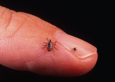 Deer ticks, one adult and one nymph, on a man's finger. Infected deer ticks transmit Lyme Disease to humans.
