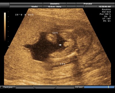 Congenital conditions may occur to a developing fetus.