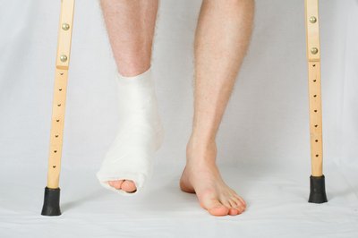 How to recover from broken ankle surgery.