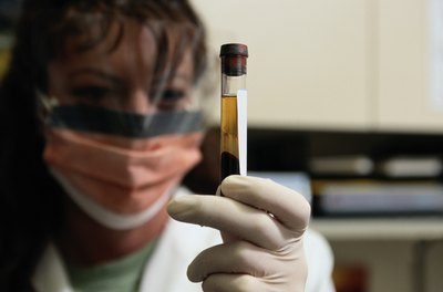 Blood test