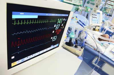 EKG in surgery room