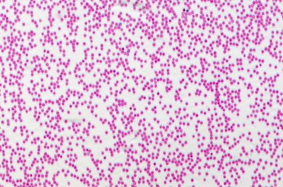 Human blood cells.