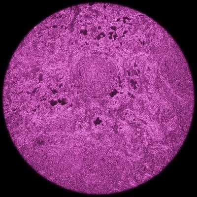 Lymphocyte.