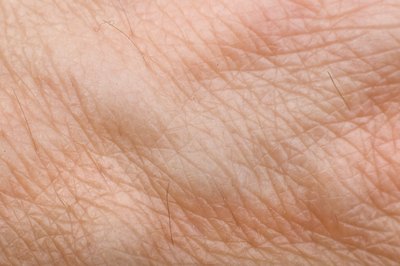 Human veins close up.