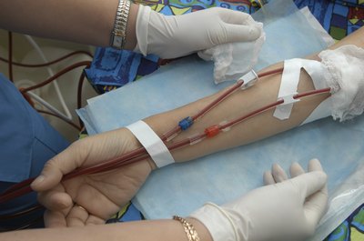 Blood infusion