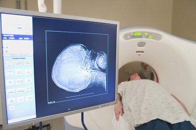 MRI machine scanning head of patient