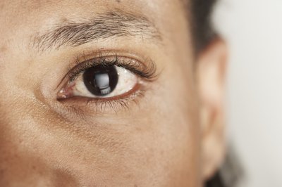 Eye mucus can be a sign of conjunctivitis.