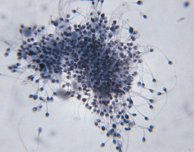 Microscopic image of Sperm