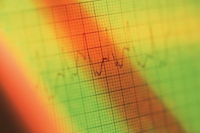 vagal maneuvers will temporarily reduce your heart rate