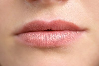 How Do You Get Staph Around the Lips?