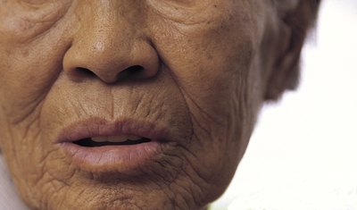Malignant melanoma may be a side effect