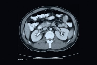 Scan of digestive system.