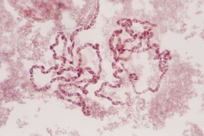 Chromosomes