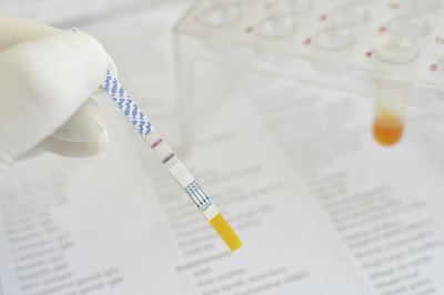 Detection of Hepatitis.