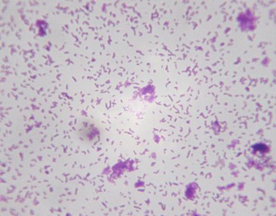 Microscopic view of bacteria.
