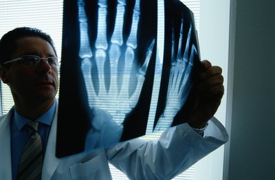 Doctor looking at x-ray of hand.