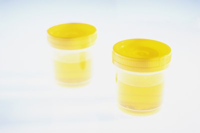 Urine sample