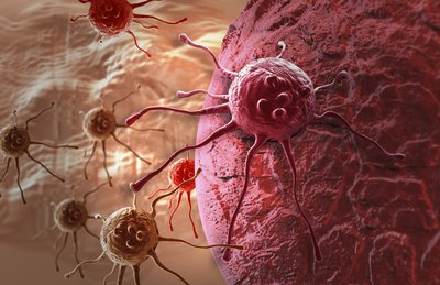 3D rendering of cancer cell.