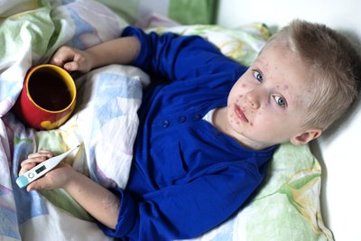 child with measles