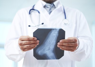 Doctor holding an xray of the foot