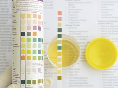 pH levels.