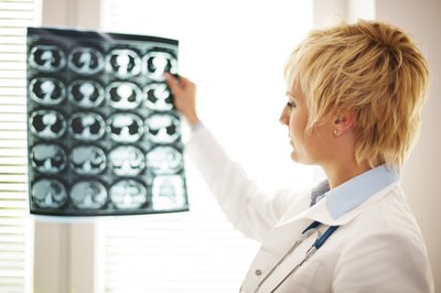 Doctor looking a brain scan results