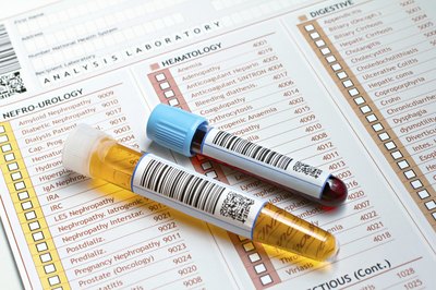 Collecting data from urine is faster and more precise than it has been in the past.